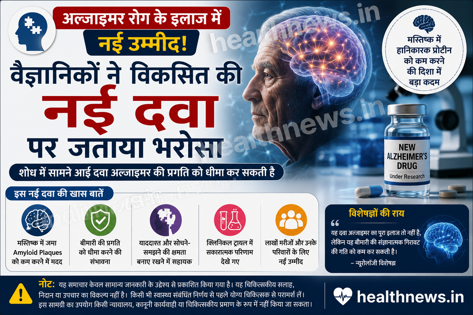 अल्जाइमर रोग के इलाज में नई उम्मीद, वैज्ञानिकों ने विकसित की नई दवा पर जताया भरोसा