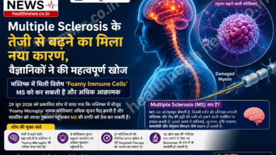 Multiple Sclerosis के तेजी से बढ़ने का मिला नया कारण, वैज्ञानिकों ने की महत्वपूर्ण खोज